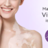 Vatiligo Treatment